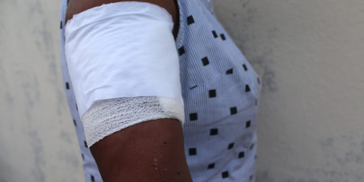 Tentative d’assassinat du Dr Anne Chimène Lamothe à Pacot