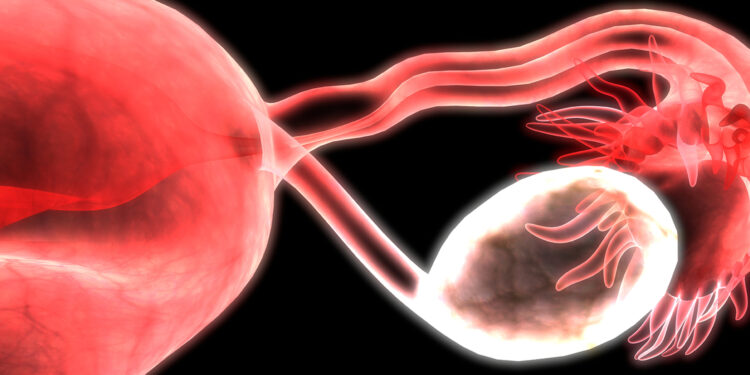 Une maladie très répandue chez les femmes haïtiennes