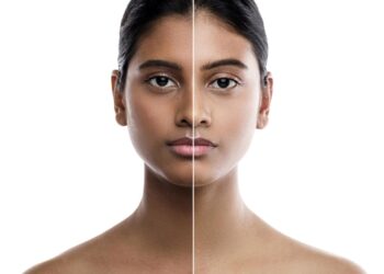 La dépigmentation à travers les prismes historique, culturel et psychologique