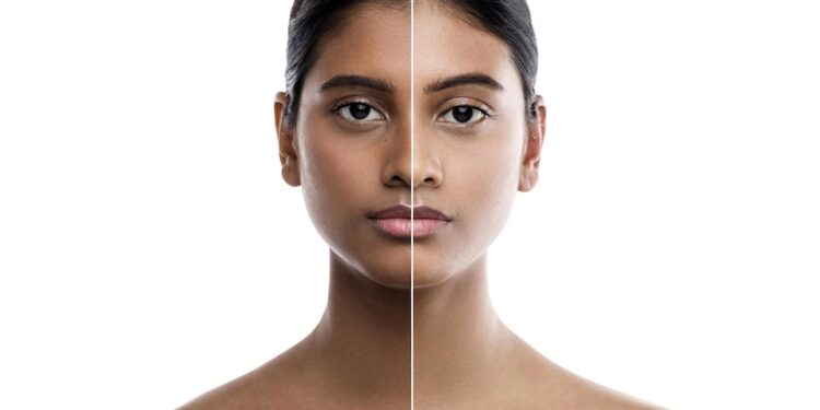 La dépigmentation à travers les prismes historique, culturel et psychologique