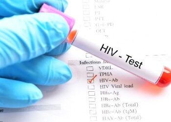 VIH : vous avez le VIH !