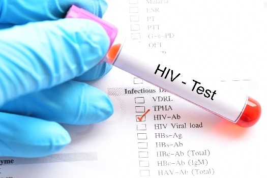 VIH : vous avez le VIH !