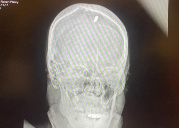 Jean-Robert Fleury, journaliste au Nouvelliste, blessé par balle