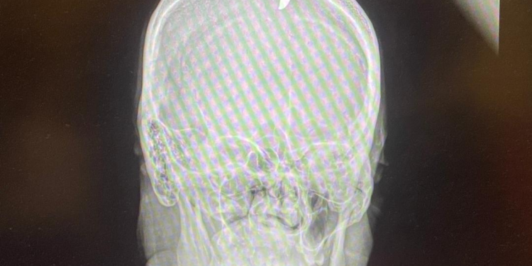 Jean-Robert Fleury, journaliste au Nouvelliste, blessé par balle